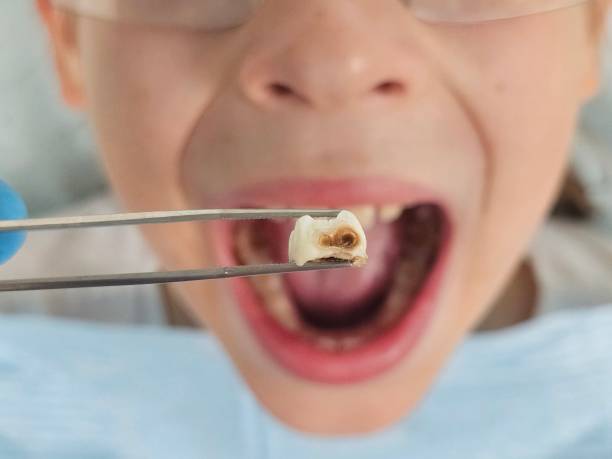 Best Walk-In Emergency Dental Services in Talty, TX